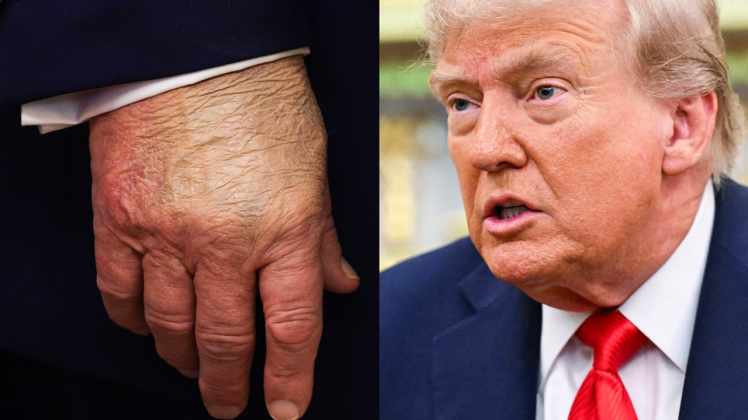 خبر مرگ ترامپ و انتشار سریع آن چه چیزی را نشان میدهد؟