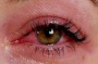 خطرات پنهان اکستنشن مژه برای سلامت چشم